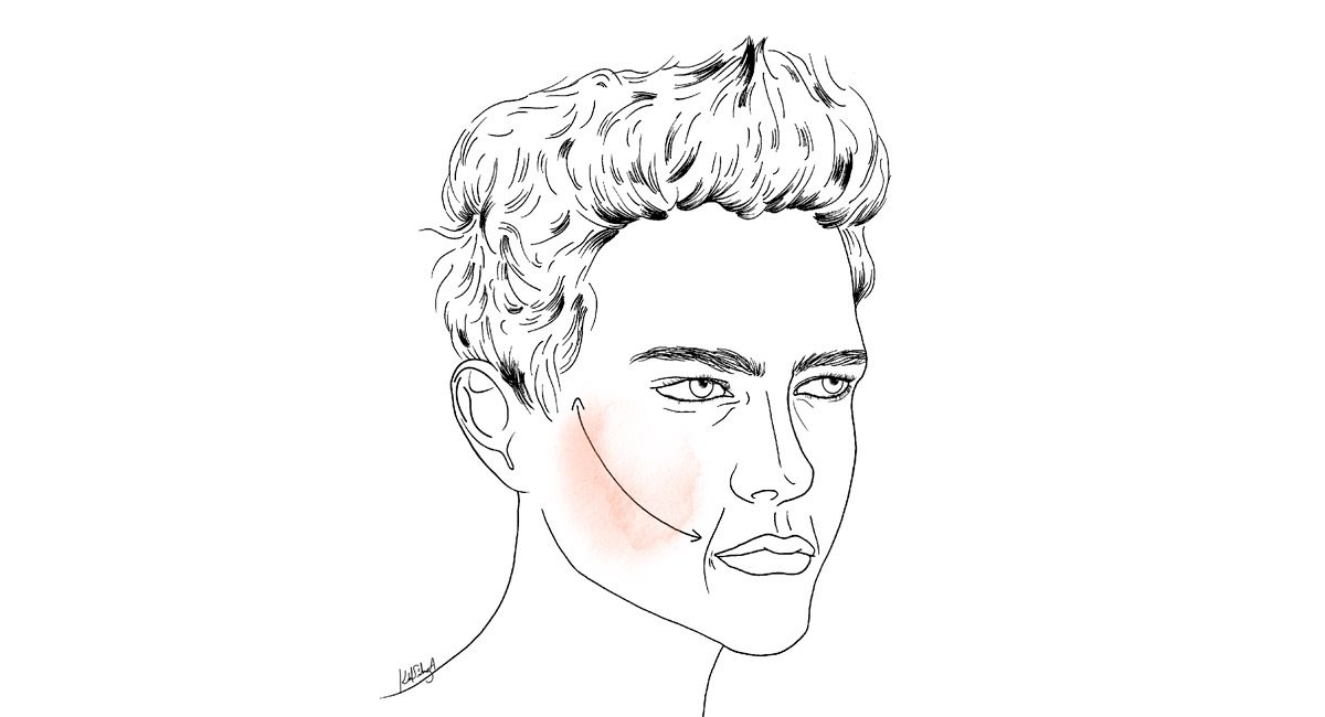 Cheek Lift