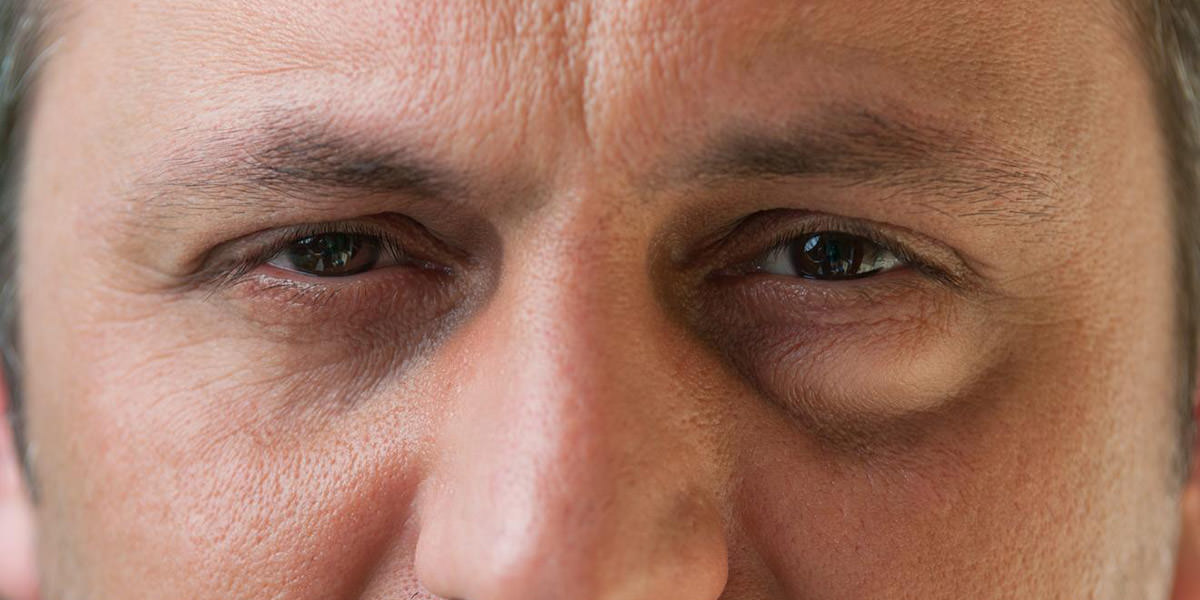 Ojos cansados tratamiento Ojos cansados tratamiento