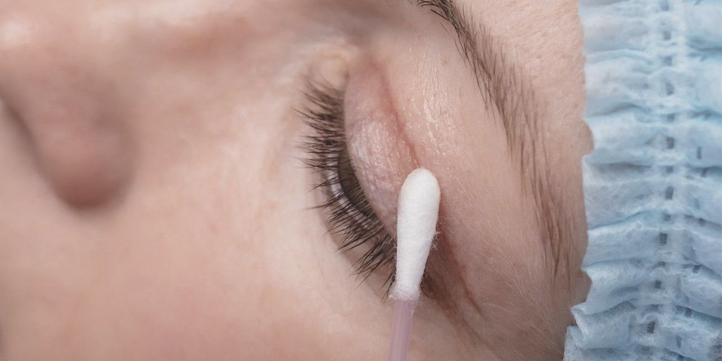 Cuidado-postoperatorio-parpado Cuidado postoperatorio de una incisión en el párpado tras blefaroplastia