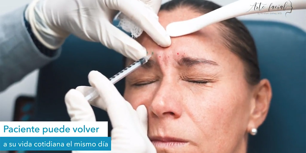 Tratamiento-Preventivo-Botox
