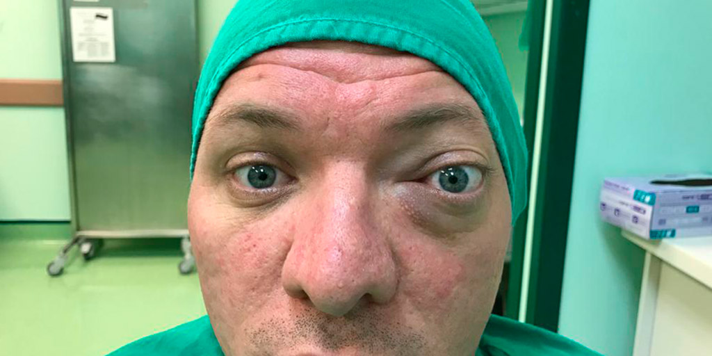 Orbital tumors