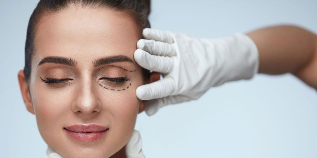 blefaroplastia–bolsas-de-ojo