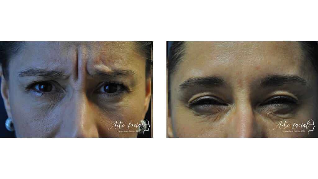 Non- surgical