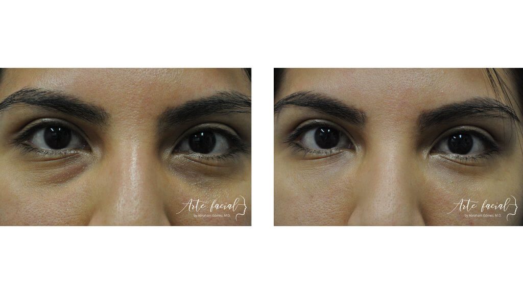 Non- surgical