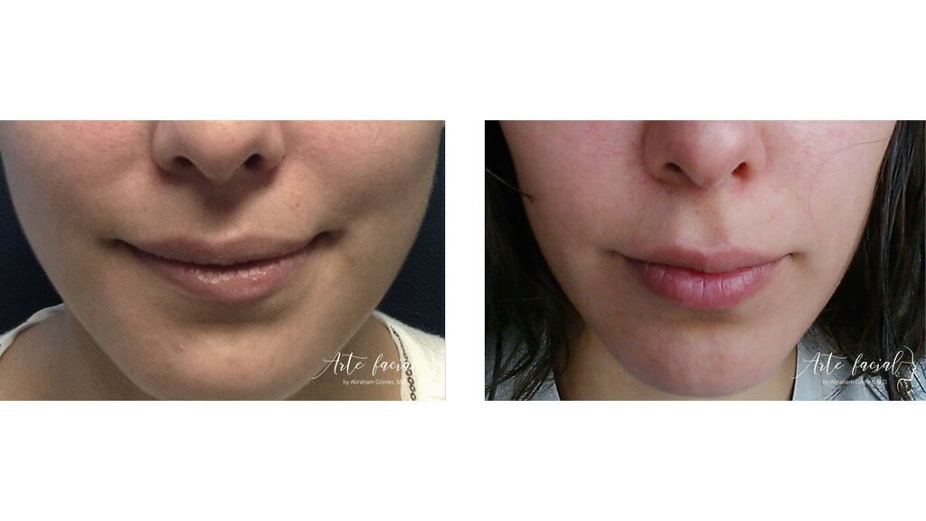 Non- surgical