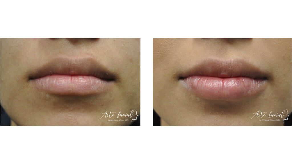 Non- surgical