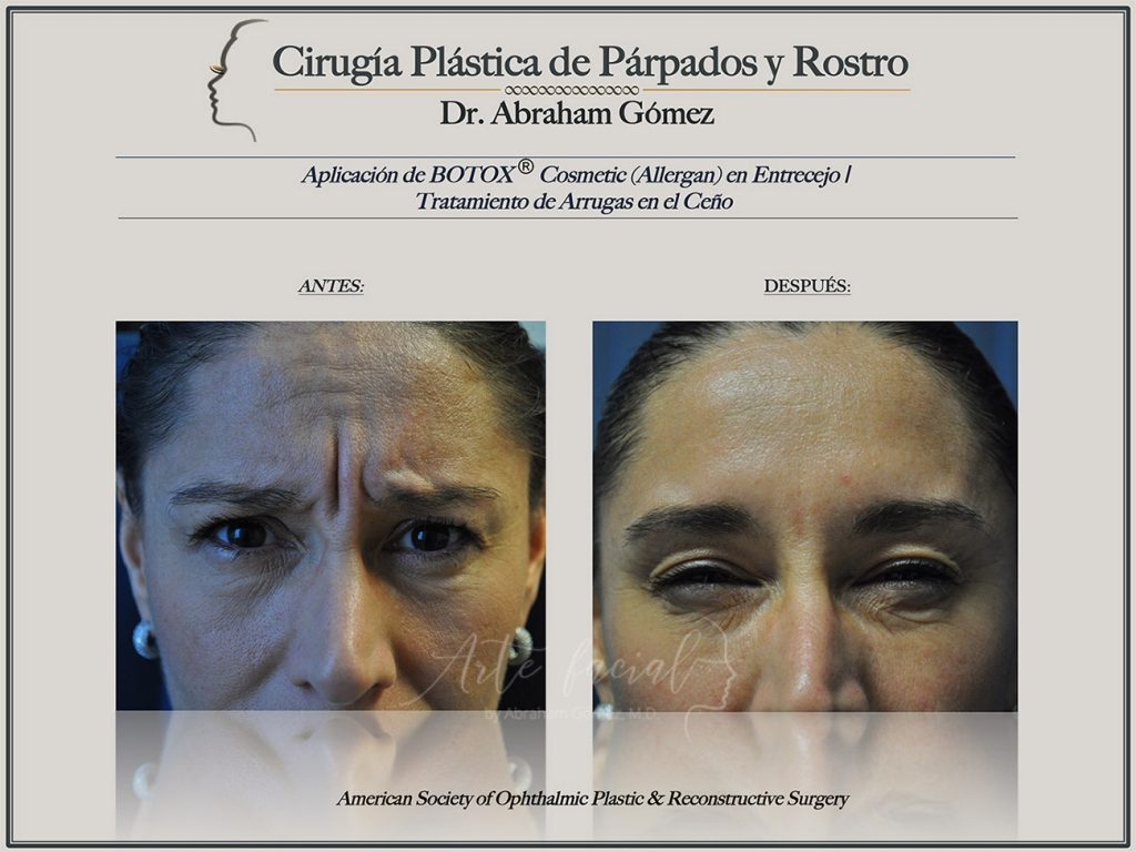 Non - surgical