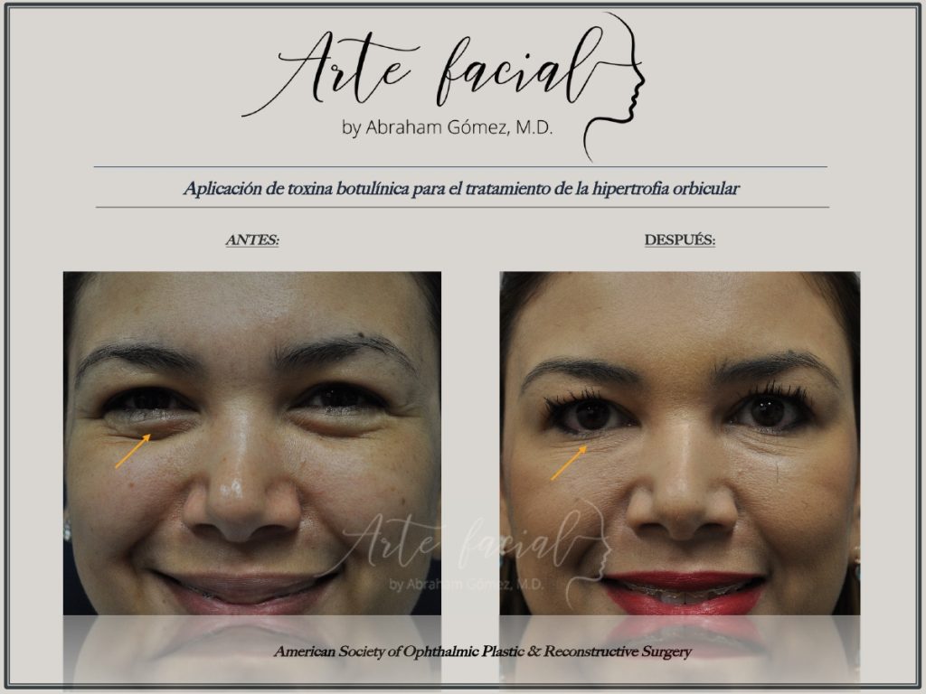 Non - surgical