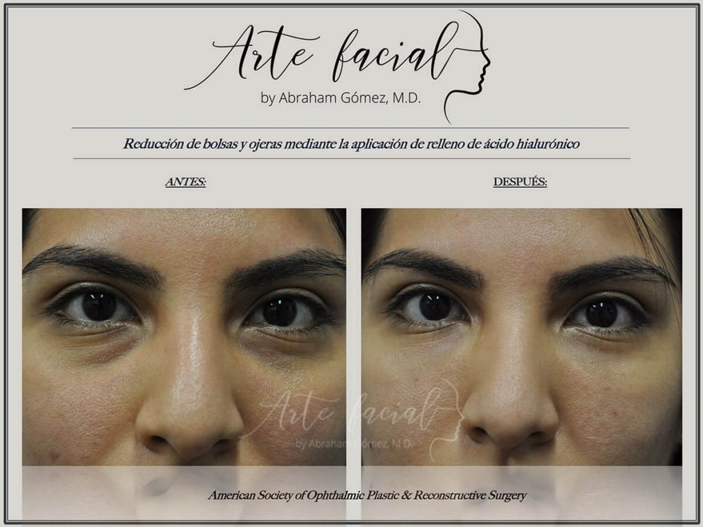 Non - surgical