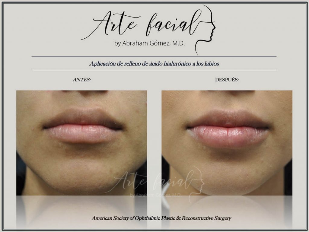 Non - surgical