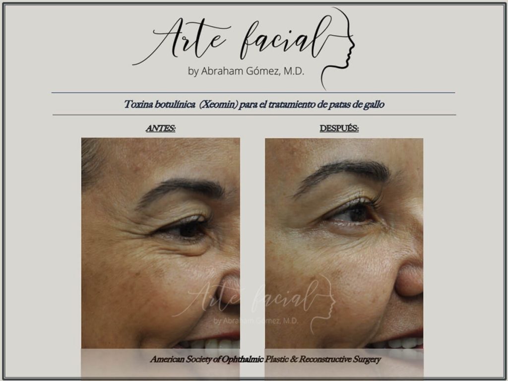 Non - surgical
