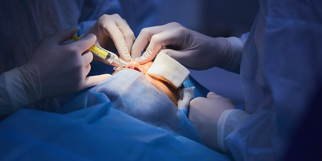Retoques en cirugía plástica de párpados Retoques en cirugía plástica de párpados - Touch-up procedures in oculoplastic surgery: why, when, and how?