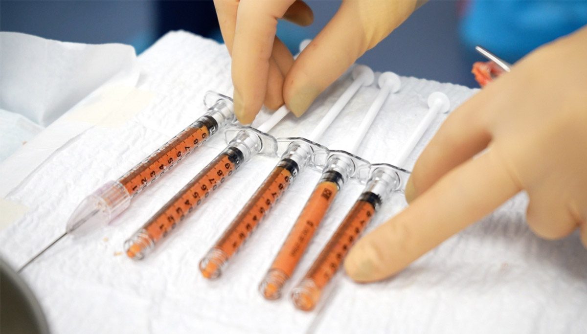 Facial Fat Grafting