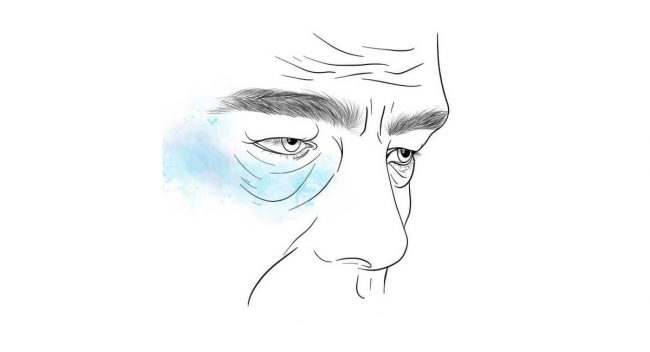 Blefaroplastia del párpado inferior