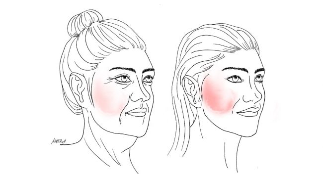 Facelift and Mini Facelift