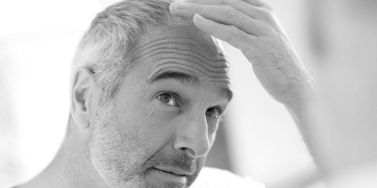 Levantamiento de frente y cejas