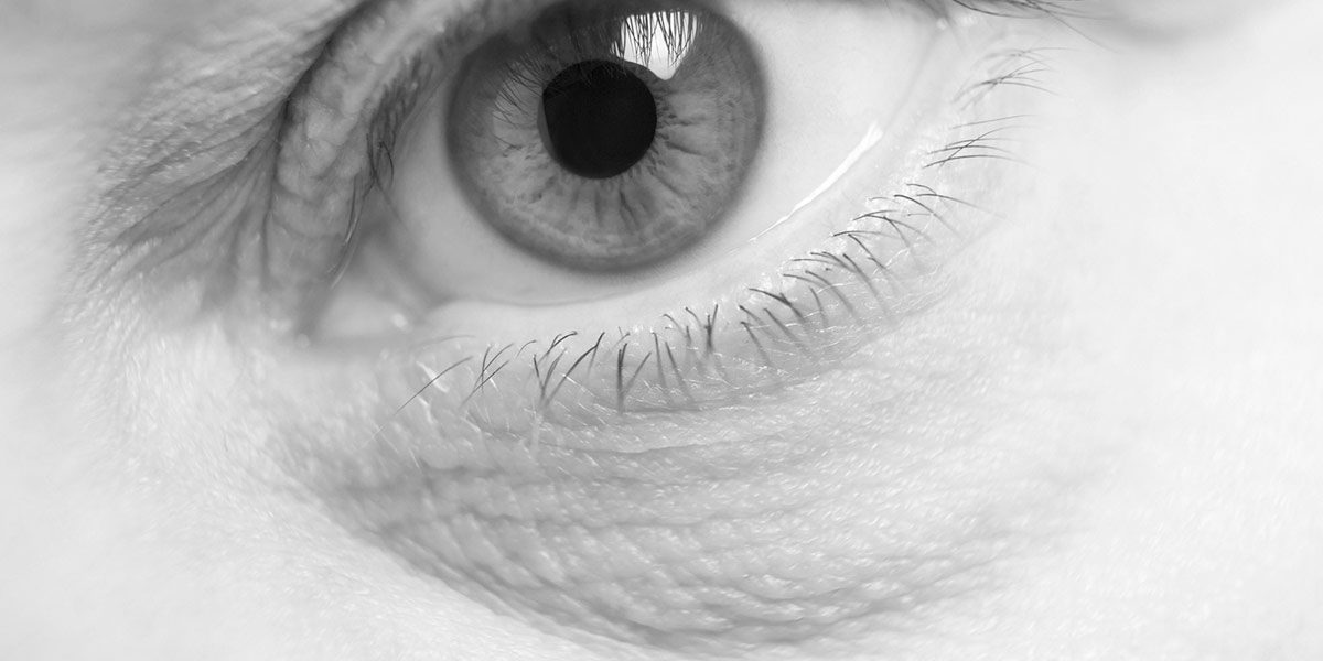 Tratamiento de bolsas y ojeras