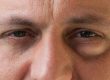 Ojos cansados tratamiento