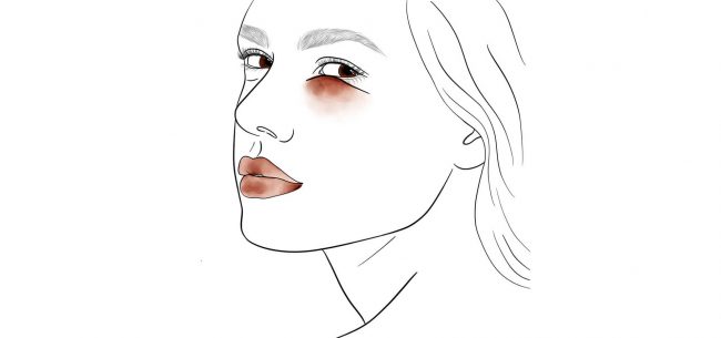 Infections of the Tear Duct