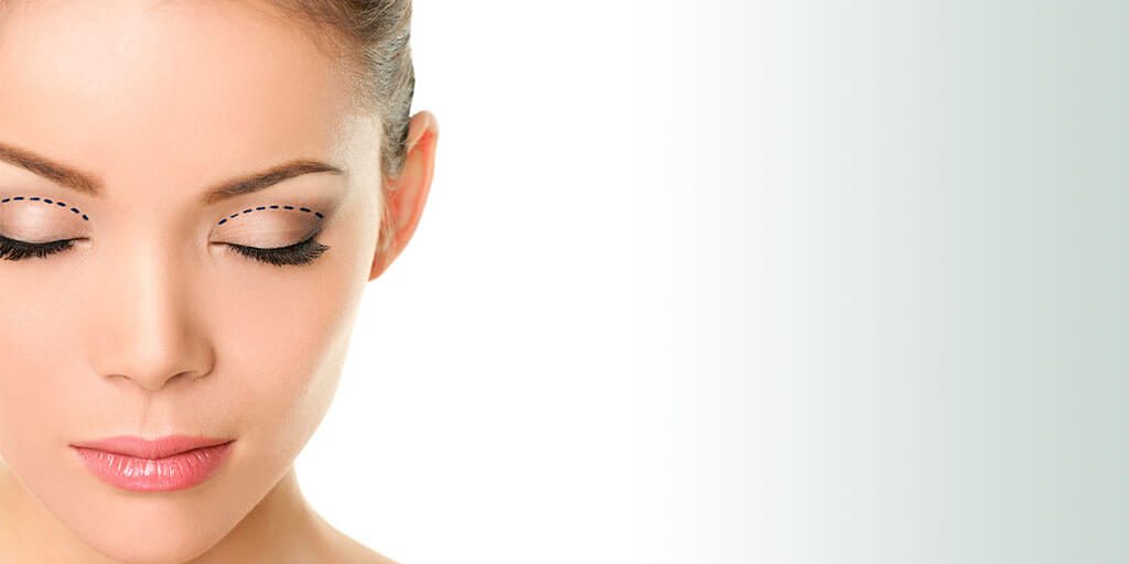 Especialistas en cirugía reconstructiva de párpados en Costa Rica