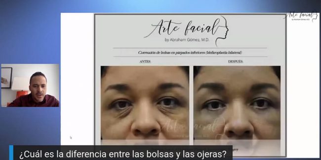 Cirugía de bolsas y ojeras - Webinar con el Dr Gómez