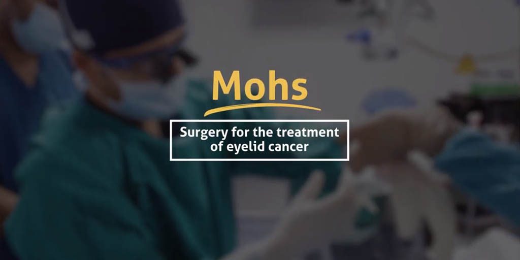Mohs surgery for the treatment of eyelid cancer