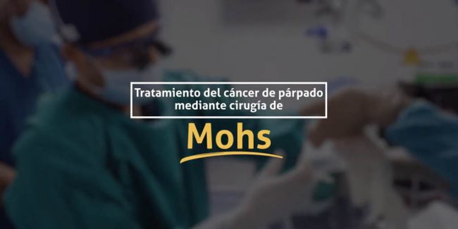 Tratamiento del cáncer de párpado mediante cirugía de Mohs.