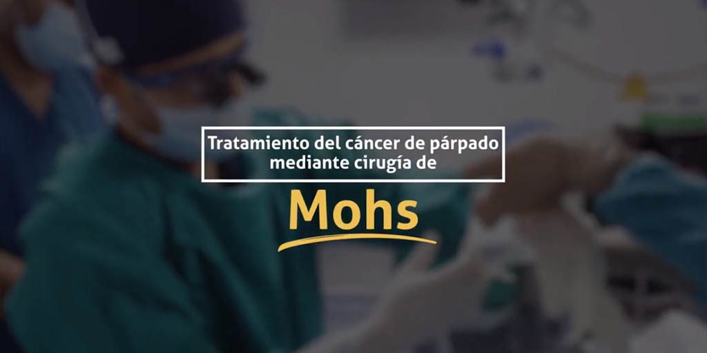 Tratamiento del cáncer de párpado mediante cirugía de Mohs.