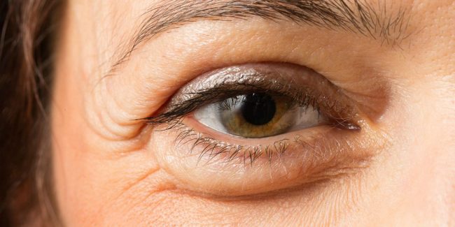 Especialistas en párpados