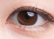 Blefaroplastia asiática - Cirugía de doble pliegue