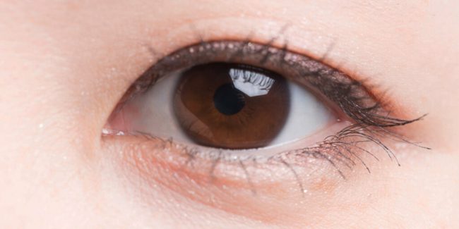 Blefaroplastia asiática - Cirugía de doble pliegue