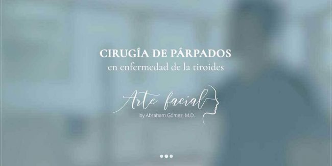 Cirugía de Párpados en la Enfermedad de Tiroides