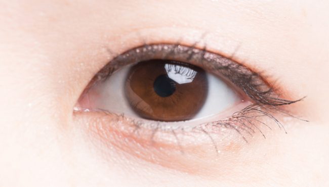 Blefaroplastia asiática: Cirugía de doble pliegue