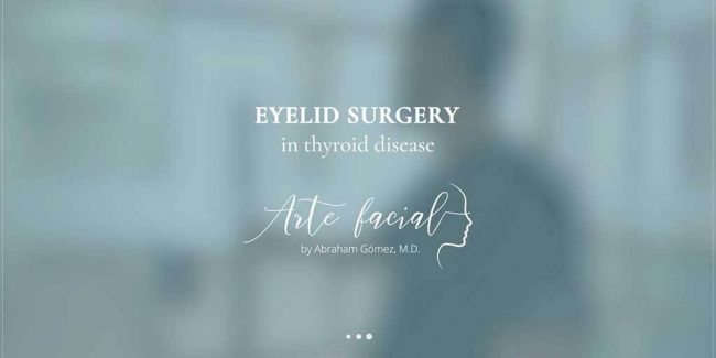 Eyelid Surgery in Thyroid Eye Disease