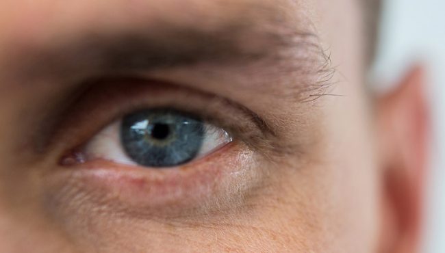 What does an eyelid specialist do