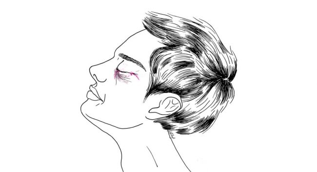 Brow lift for men - Eyelid plastic surgery for men