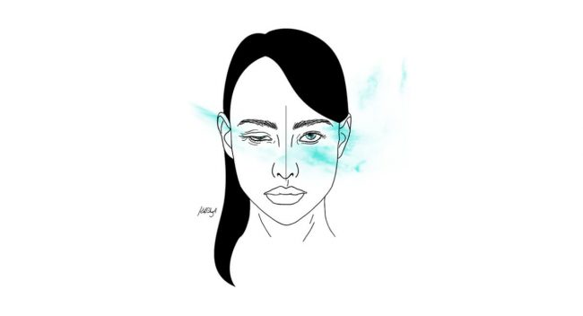 Hemifacial spasm - Espasmo Hemifacial