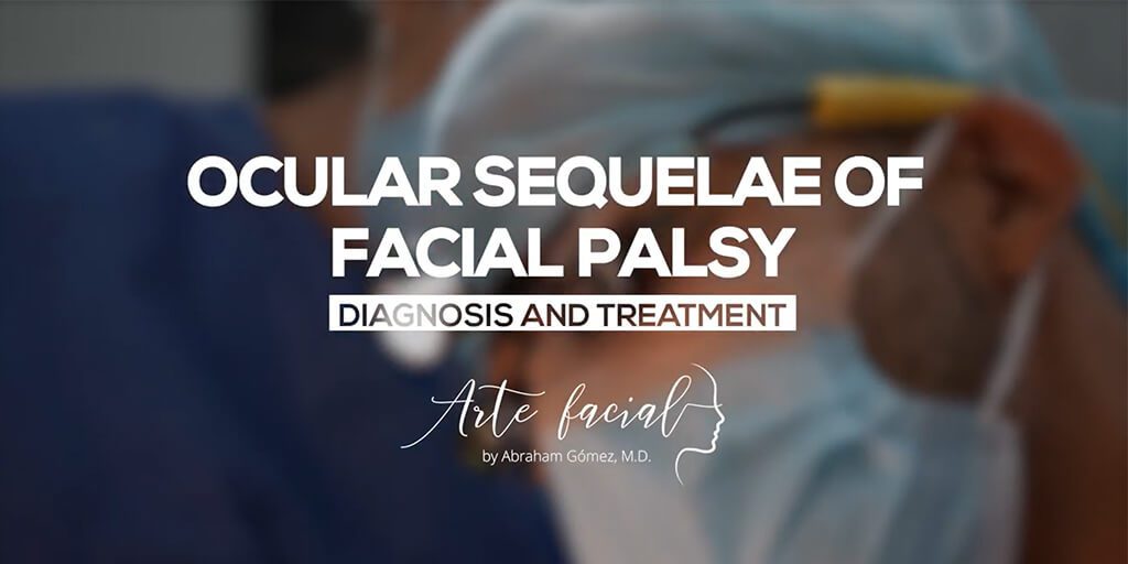 Ocular Sequelae of Facial Palsy - Diagnosis and Treatment