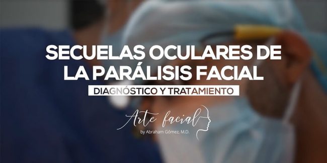 Secuelas oculares de la parálisis facial - diagnóstico y tratamiento