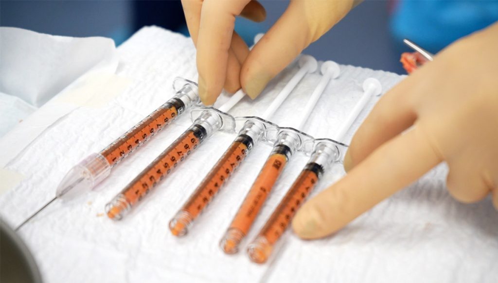 Injerto de grasa en la cara