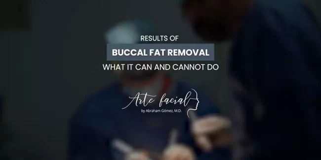 Results Buccal Fat Removal