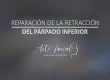 Reparación de la retracción del párpado inferior