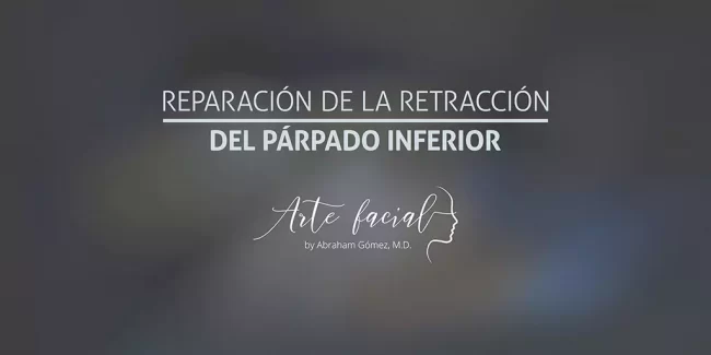 Reparación de la retracción del párpado inferior