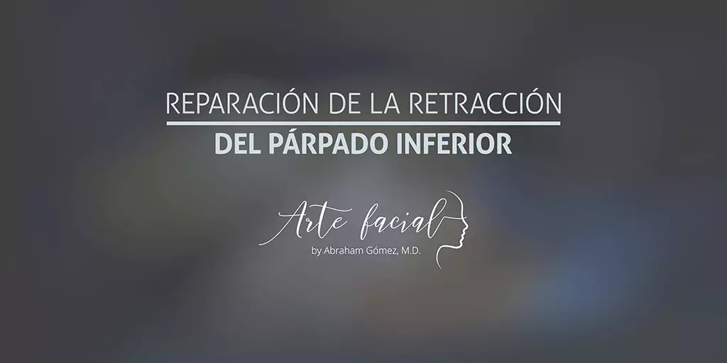 Reparación de la retracción del párpado inferior