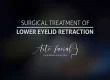 lower eyelid retraction