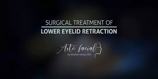 lower eyelid retraction