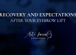 Recovery after a brow lift