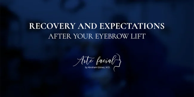 Recovery after a brow lift