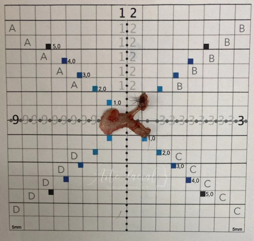 Espécimen listo para ser analizado