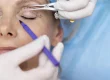 Complicaciones después de una cirugía de párpados | How are complications managed after eyelid surgery? - Costa Rica